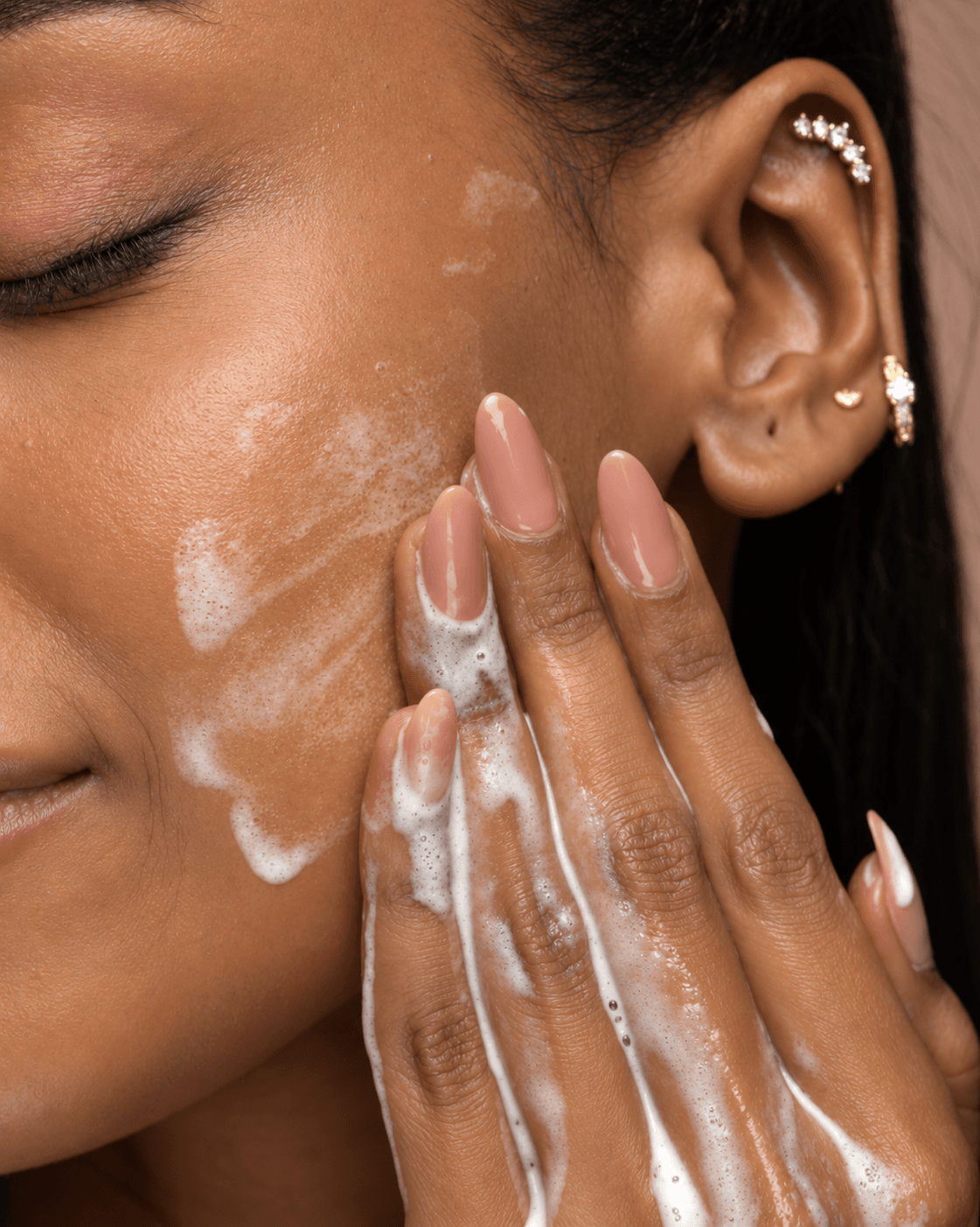 Skin showing sun damage